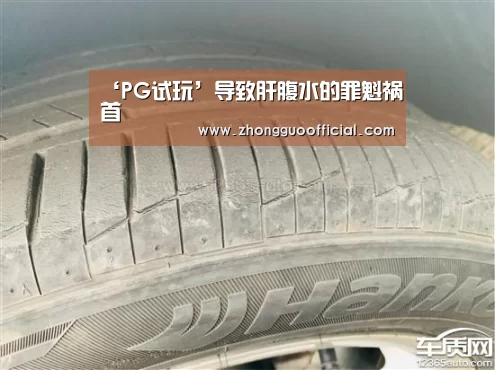 ‘PG试玩’导致肝腹水的罪魁祸首(图4) PG中国